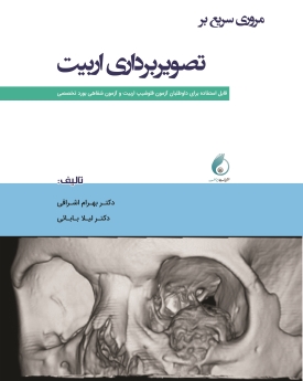 مروری سریع بر تصویربرداری اربیت